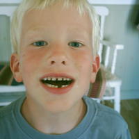 Finn-Johan tappade sin första tand